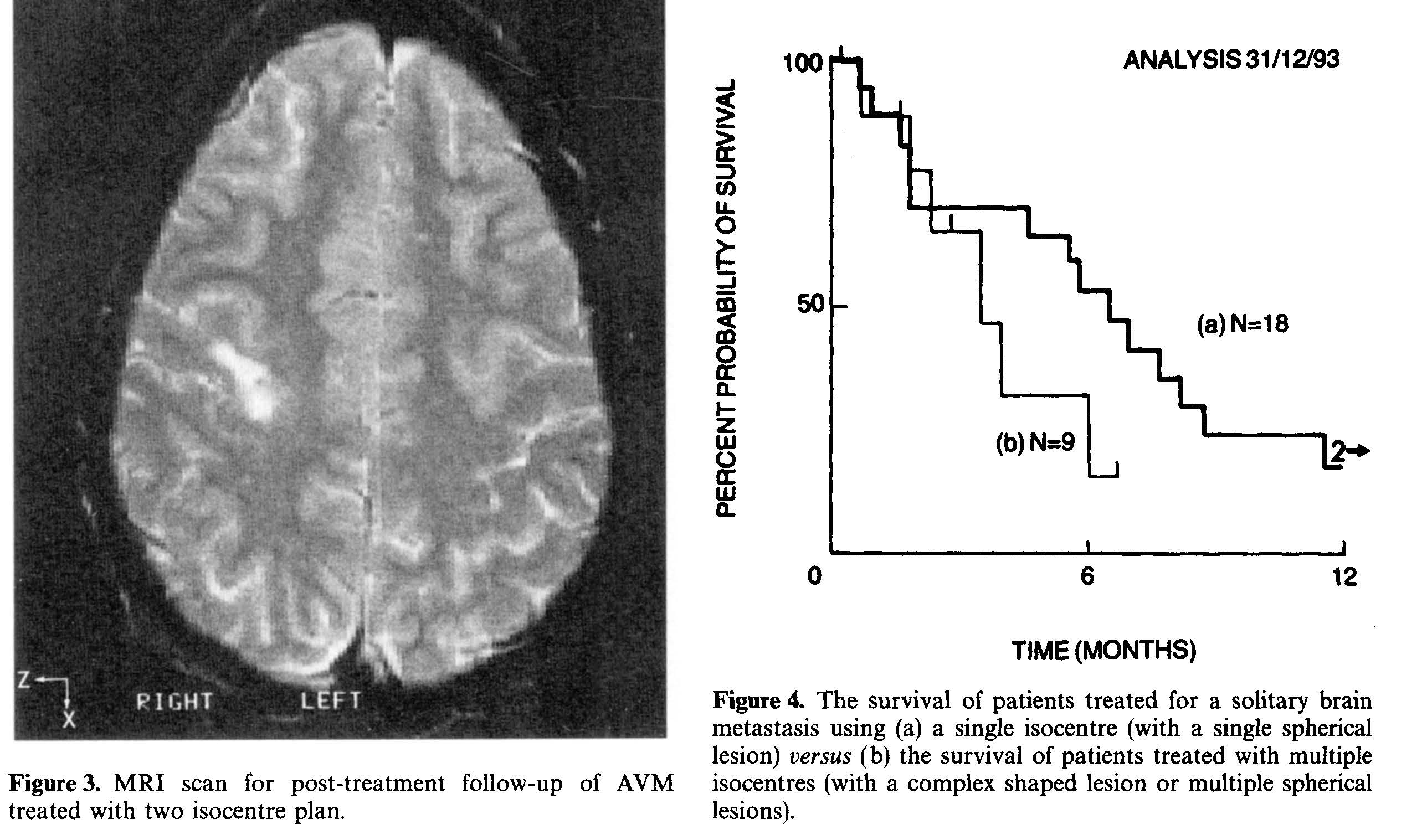 Isocentre treatment for radiosurgery