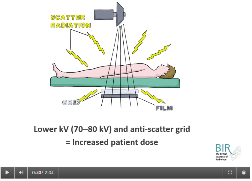 Patient on bed Patient on bed